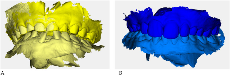 Figure 14