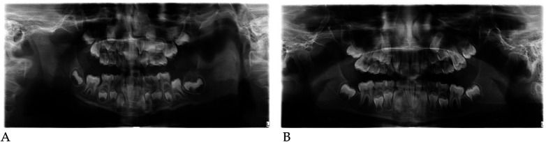Figure 16