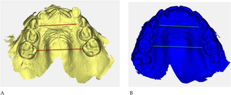 Figure 17