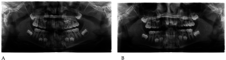 Figure 20
