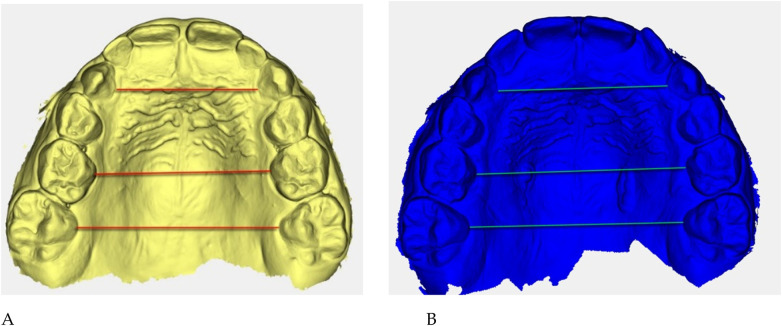 Figure 21