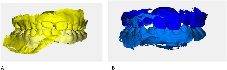 Figure 22