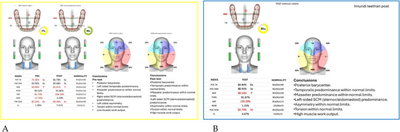 Figure 23