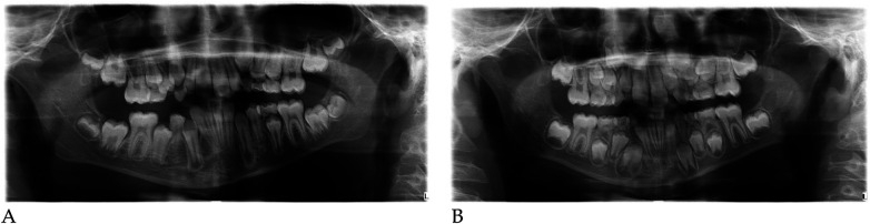Figure 28