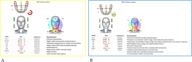 Figure 31