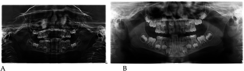Figure 32