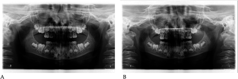 Figure 36