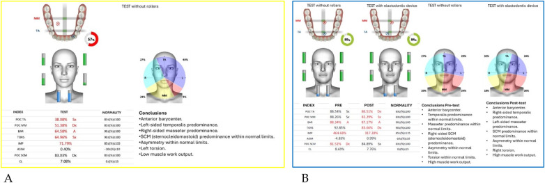 Figure 43