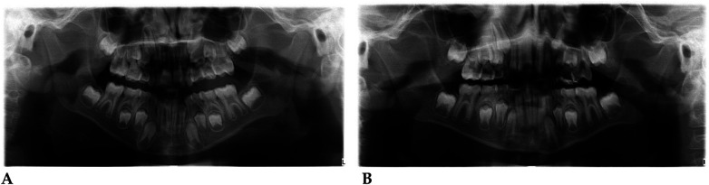 Figure 44