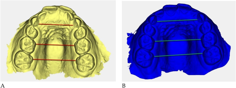 Figure 45