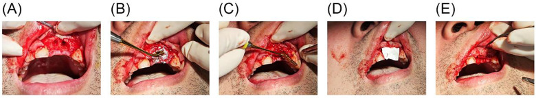 Figure 1