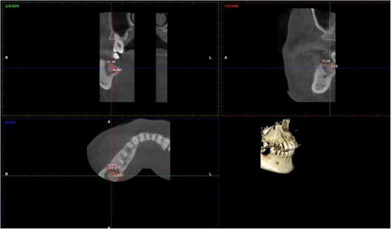 Figure 2