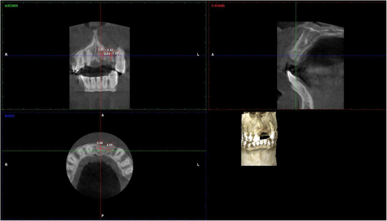 Figure 3