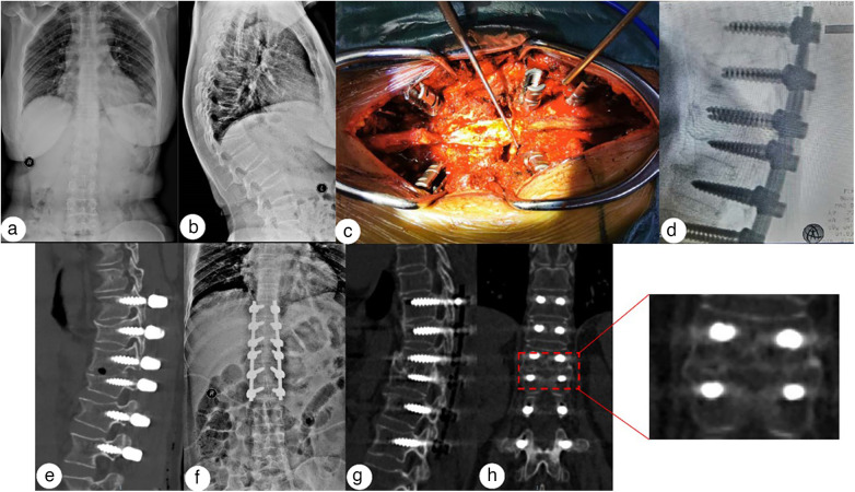 Figure 3