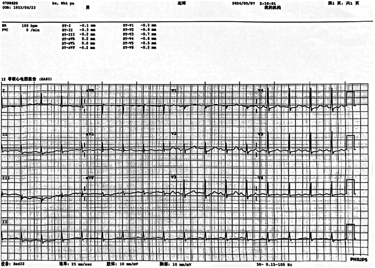 Figure 1