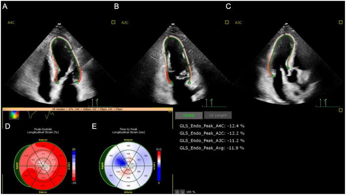 Figure 2
