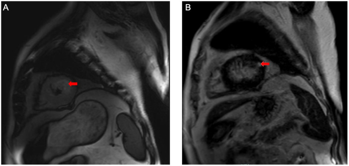 Figure 3