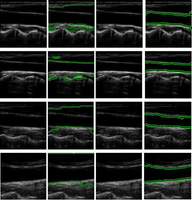 Figure 11