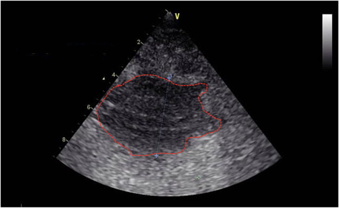 Figure 6