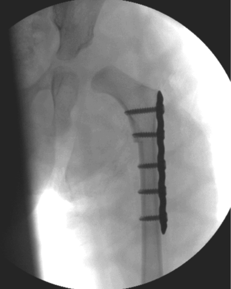 Figure 4