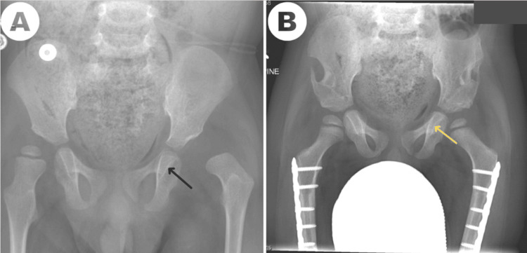 Figure 10
