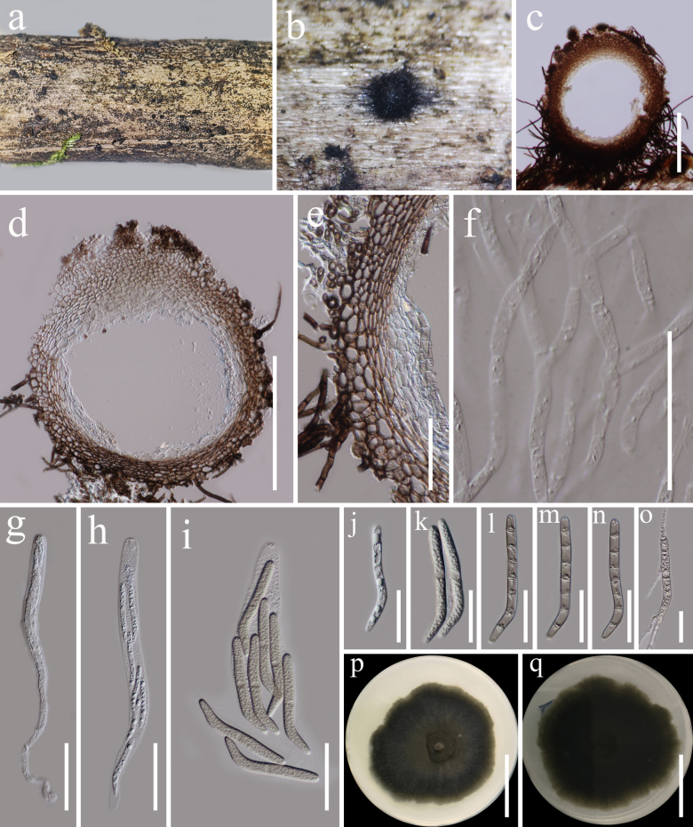 Figure 14