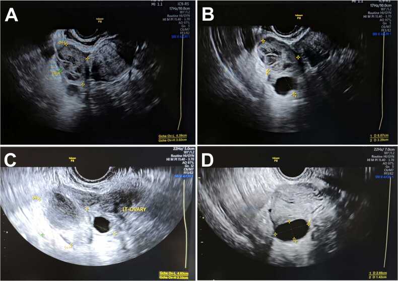 Figure 2