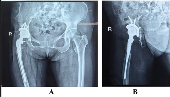 Figure 18