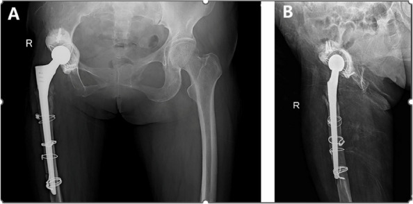 Figure 19