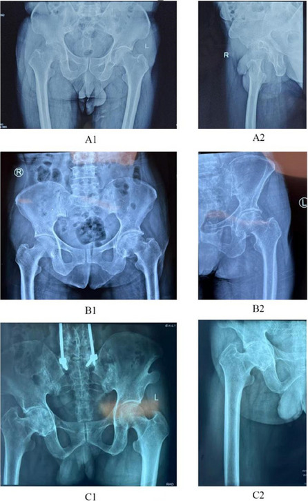 Figure 21