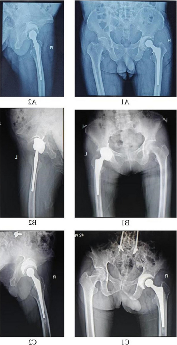 Figure 22