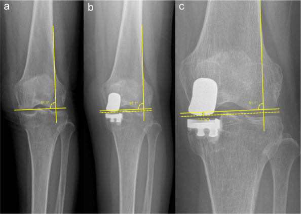 Figure 28
