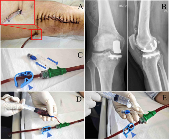 Figure 32
