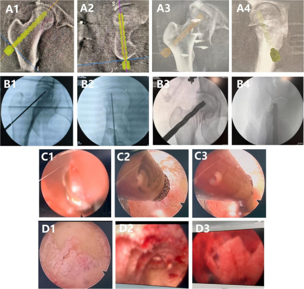 Figure 33