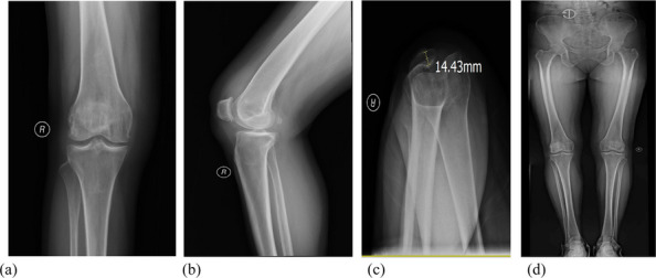 Figure 41