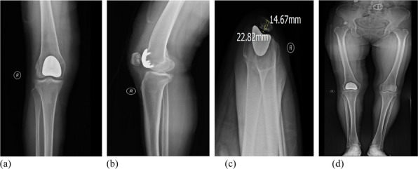Figure 43