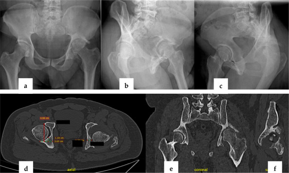 Figure 44