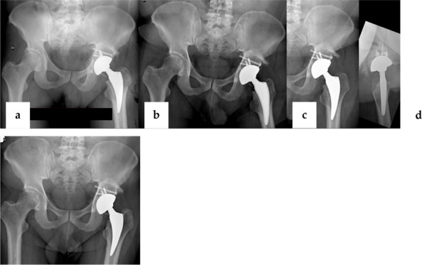 Figure 45