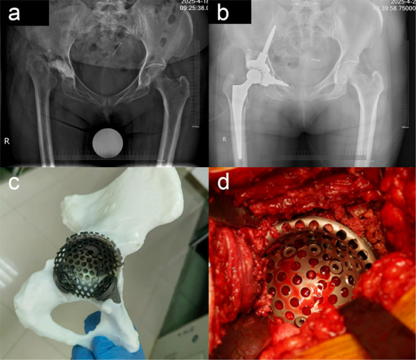 Figure 48