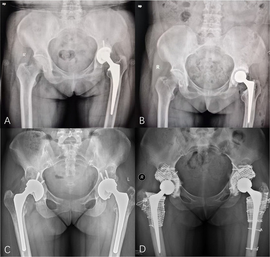 Figure 54