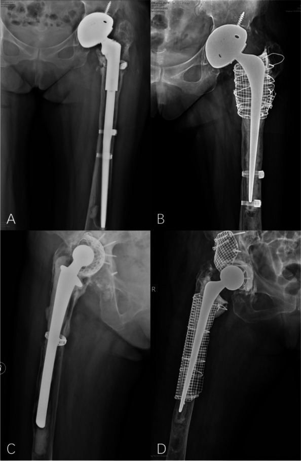 Figure 55