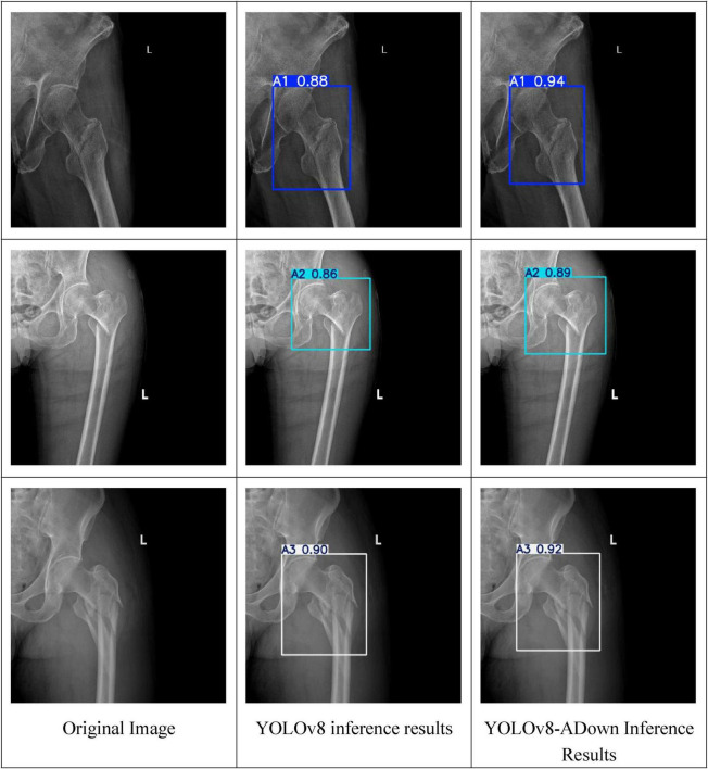 FIGURE 11