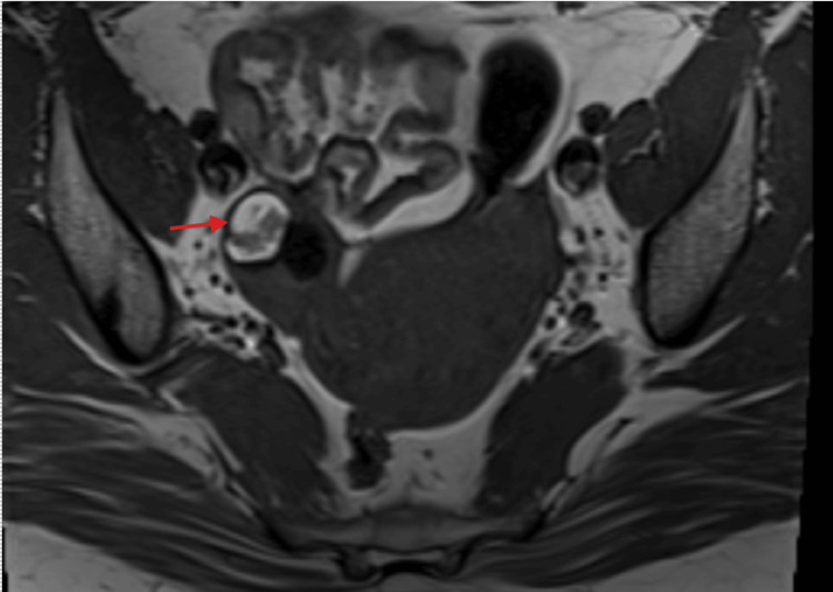Figure 7