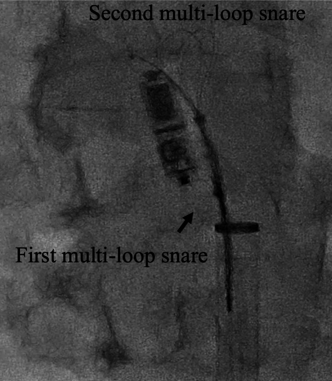 FIGURE 4