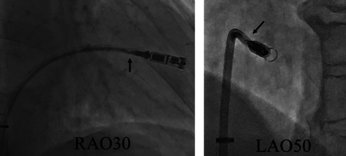 FIGURE 1