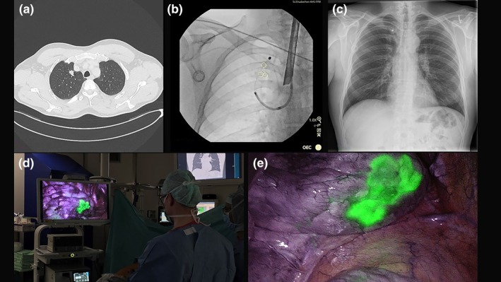 FIGURE 3