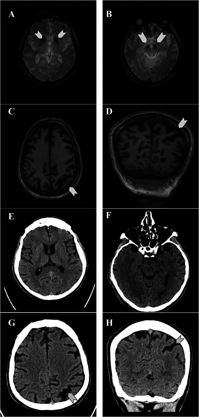 FIG 1