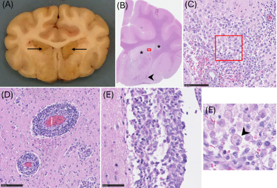FIGURE 3