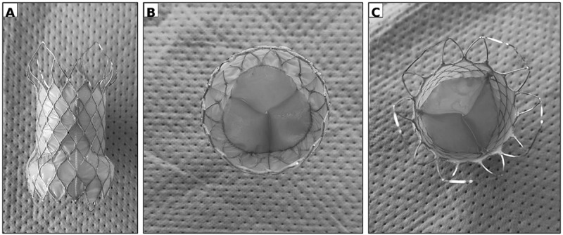 Figure 2