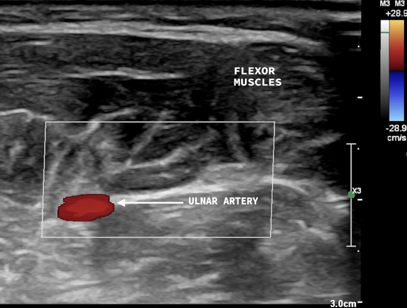 Figure 5